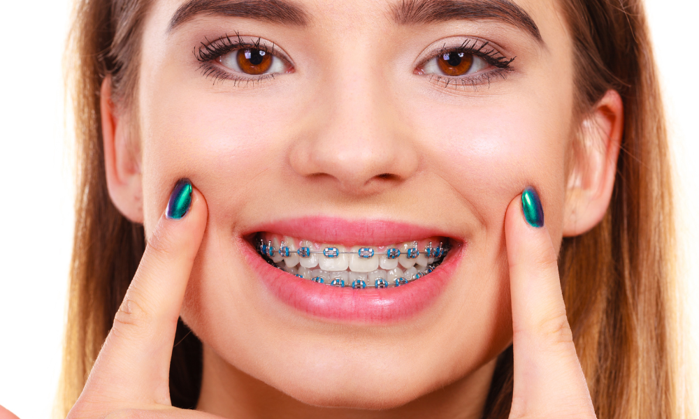 invisalign vs tradional braces post1